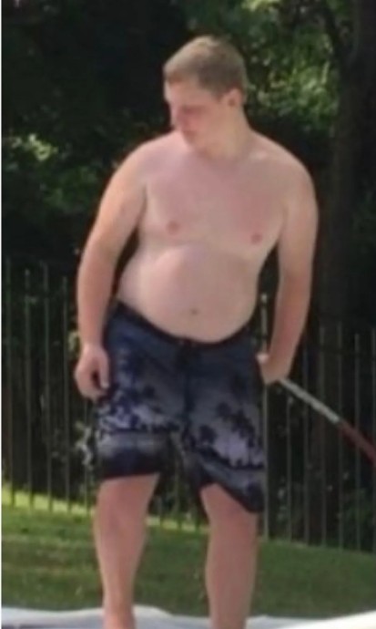 Before image of weight loss transformation